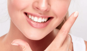 Teeth Whitening treatment in Ardmore.