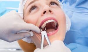 Tooth Extraction