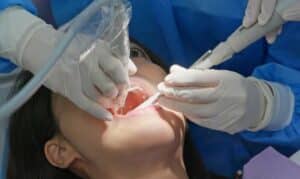 Dental Implants in Ardmore