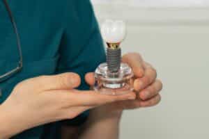 Dental Implants in Ardmore