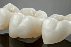 Does It Hurt to Get a Dental Crown?