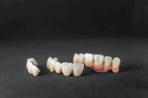 Expert Tips to Care for Your Dental Crowns