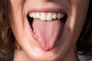 Bumps on the Tongue: A Hidden Reason Teeth Don’t Feel Clean