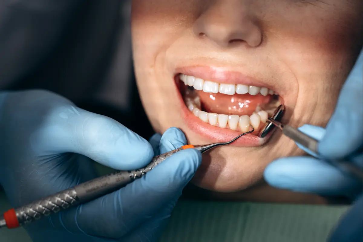 close up view a doctor treats a person s teeth 2024 10 18 11 01 31 utc 5