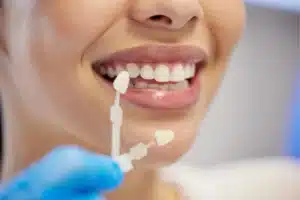Dental crown protecting a fractured tooth
