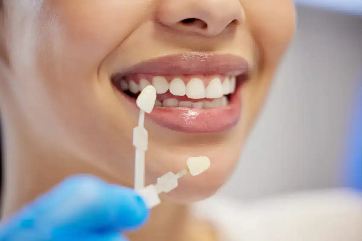 shot of an unrecognisable woman having her teeth c 2025 04 06 01 11 09 utc