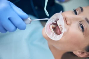 Food Keep Getting Stuck in One Tooth?